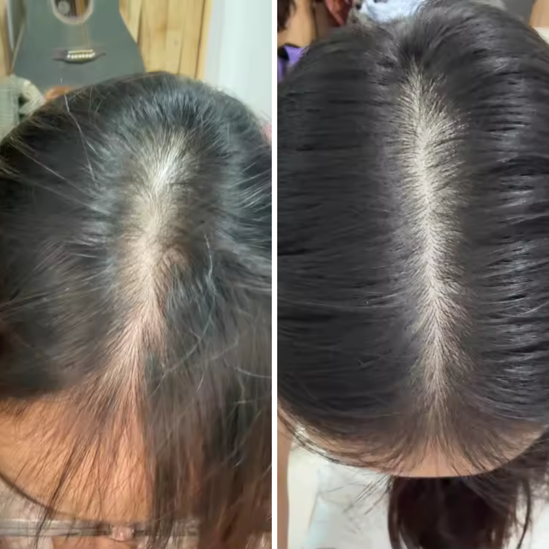 After 3 months of use