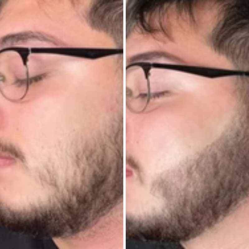 After 6 weeks of use