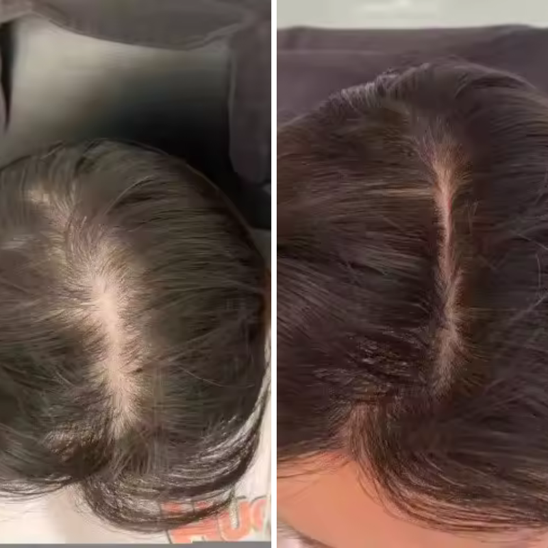 After 3 months of use