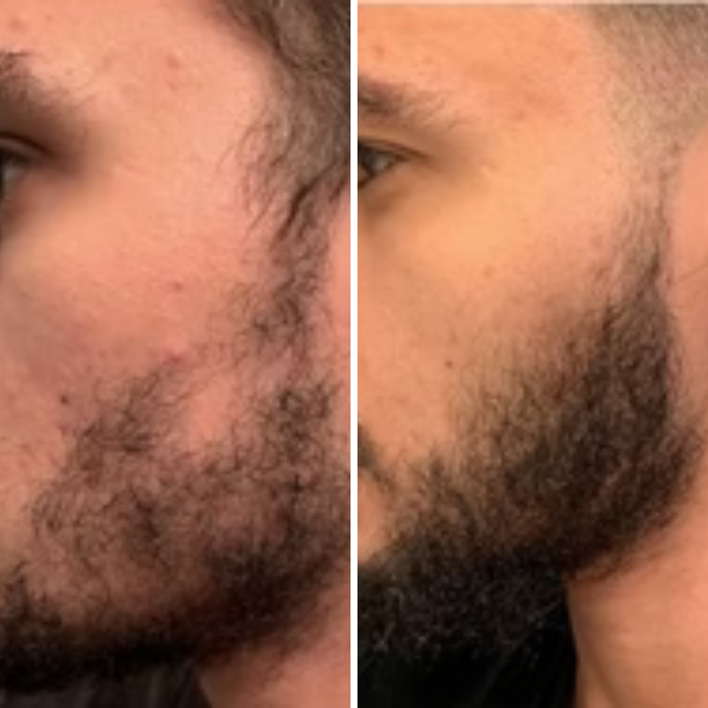 After 3 months of use