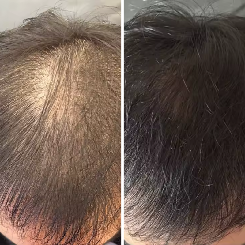 After 2 months of use