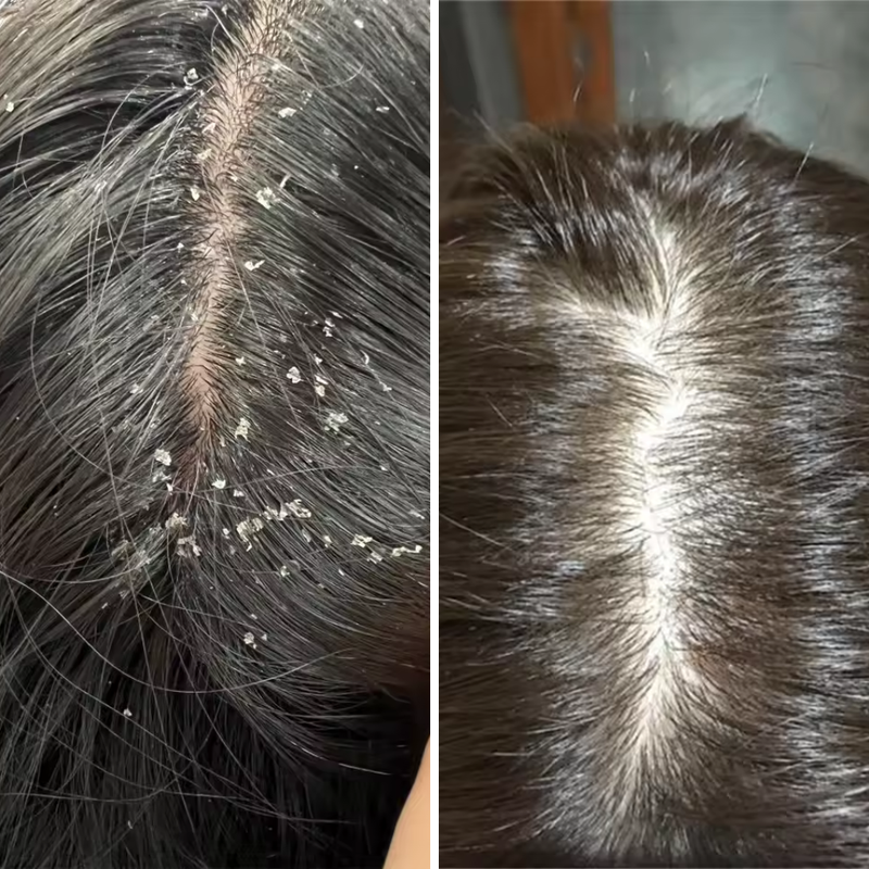 After 4 times of use