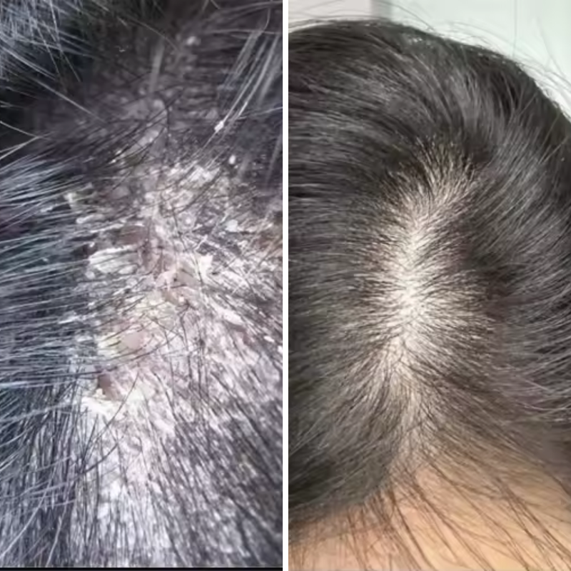 After 9 times of use