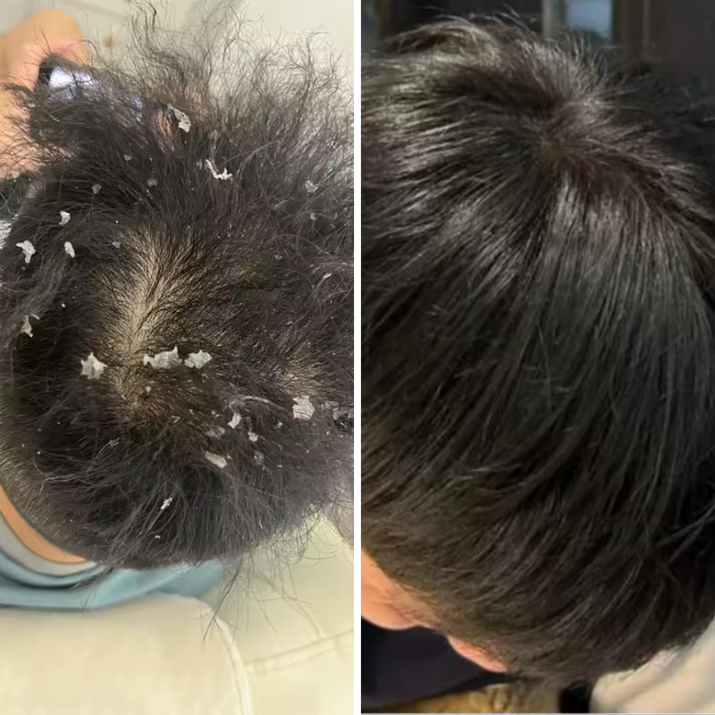 After 3 times of use