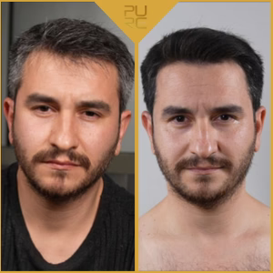 After 7 times of use