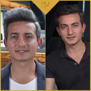 After 4 weeks of use